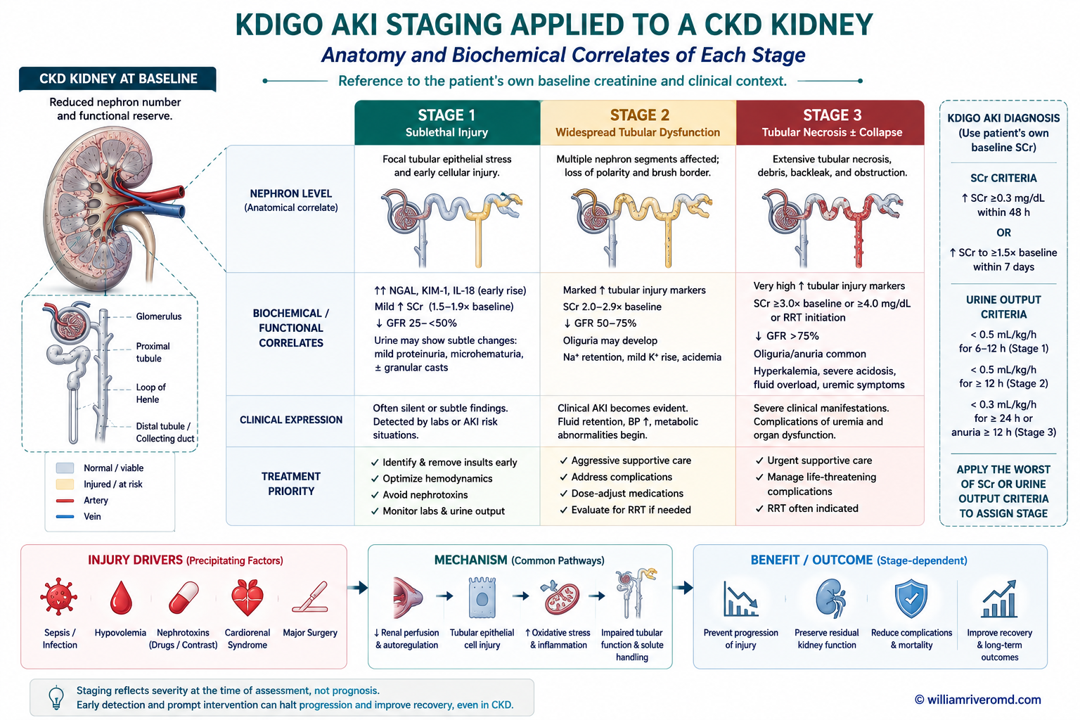 KDIGO AKI Stages in CKD Patients — Creatinine and Urine Output Criteria infographic showing Stage 1 amber, Stage 2 red-orange, and Stage 3 deep crimson with clinical thresholds and actions