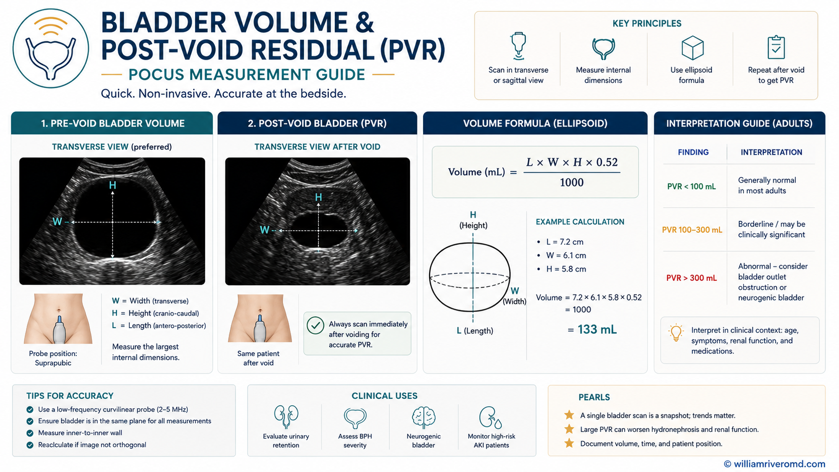 Figure 3 — Bladder volume and post-void residual measurement. Suprapubic transverse B-mode panel (Width × Transverse calipers) + sagittal B-mode panel (Height caliper) + formula card showing Volume ≈ 0.52 × W × T × H (mL) with PVR thresholds and the retention decision point.