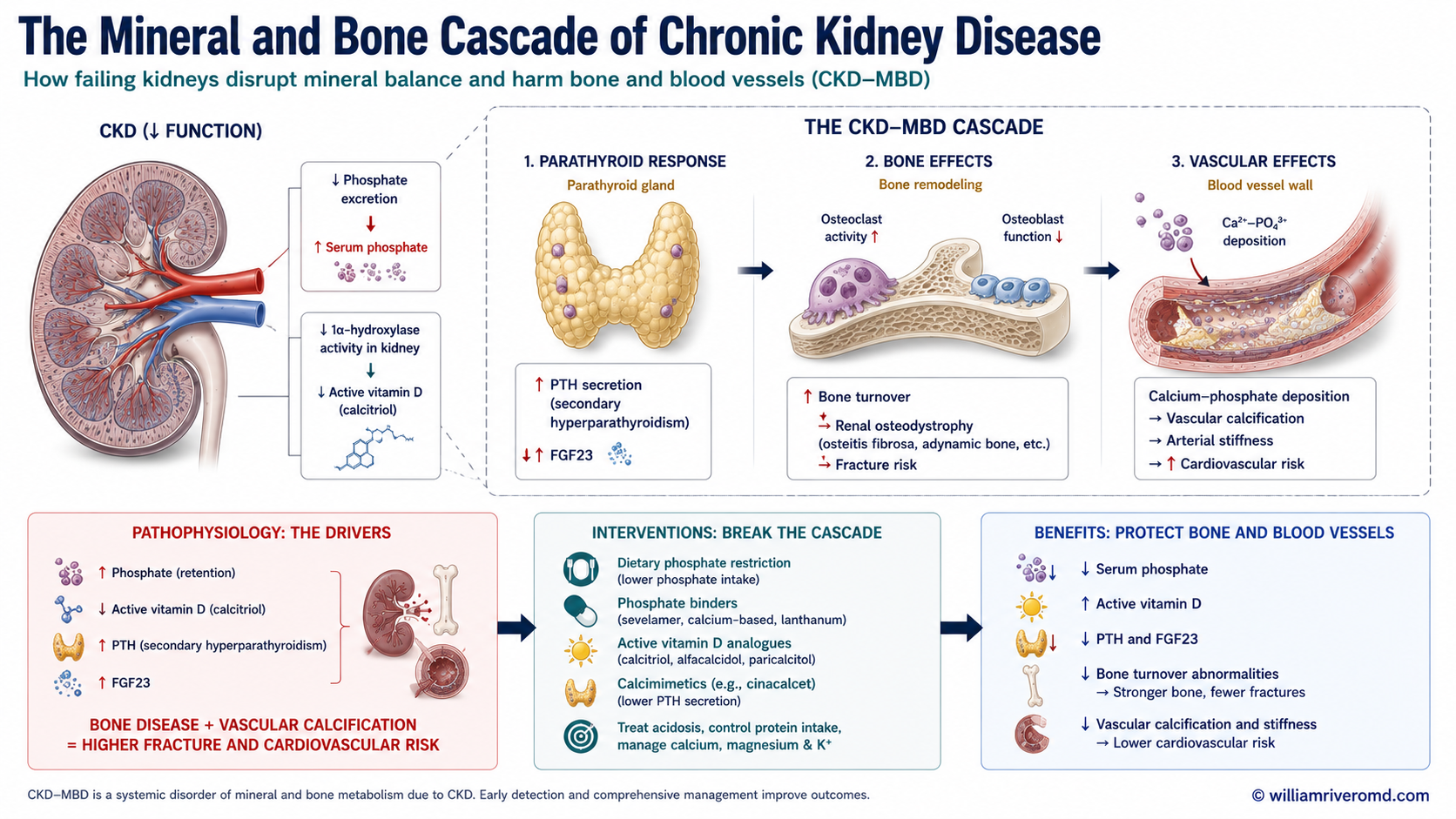 Biomedical mechanism schematic of CKD-MBD: failing kidneys retain phosphate and underproduce active vitamin D, driving secondary hyperparathyroidism with high PTH and FGF23, leading to bone disease and vascular calcification, reversed by phosphate binders, active vitamin D and calcimimetics