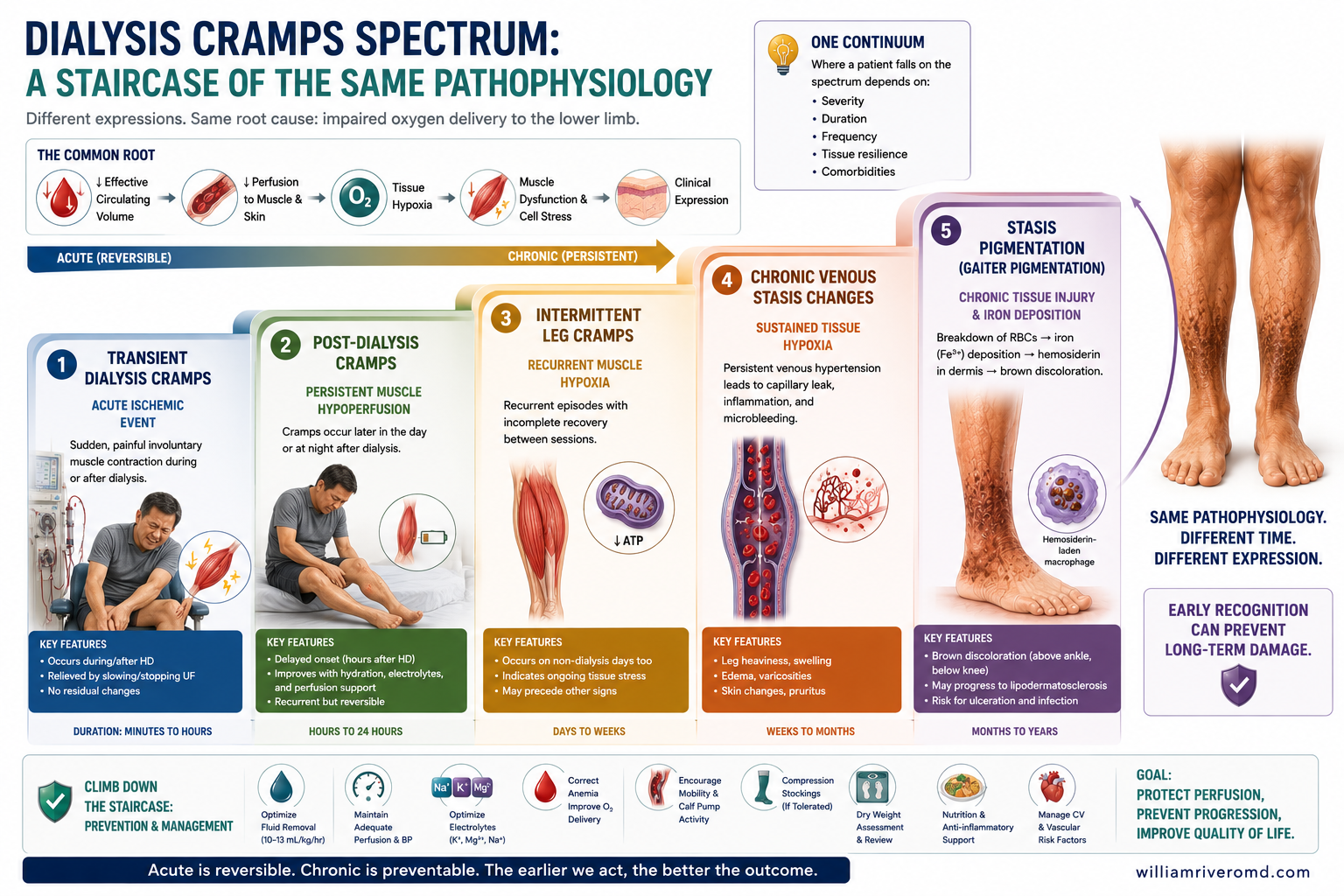 Seven-stage horizontal staircase of the Hypoxic Lower-Limb Spectrum, from subclinical through critical limb-threatening ischemia, with the diabetes-accelerator rail underneath.