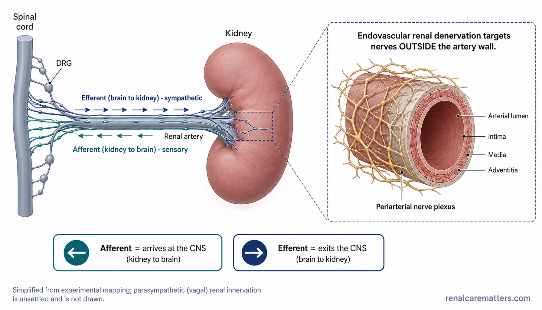 Cross-section schematic. A kidney at right receives a renal artery from the left. A zoomed circle shows the periarterial nerve plexus wrapping the artery, with a navy arrow labelled efferent (out from spinal cord) running toward the kidney and a teal arrow labelled afferent (in toward spinal cord) running away from it.