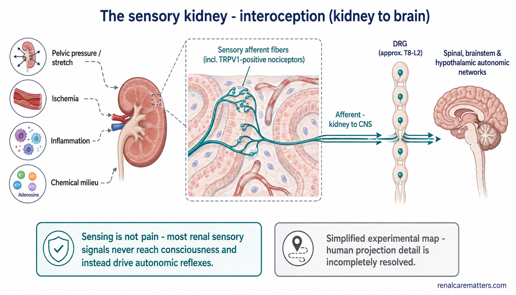 Schematic of the sensory kidney: a kidney receives four internal signals — pelvic pressure or stretch, ischemia, inflammation, and the local chemical milieu — that activate sensory afferent nerve fibers (noxious-signal nociceptors); teal afferent arrows travel from the kidney to the dorsal root ganglia at spinal levels T8 to L2 and on to spinal, brainstem, and hypothalamic autonomic networks.