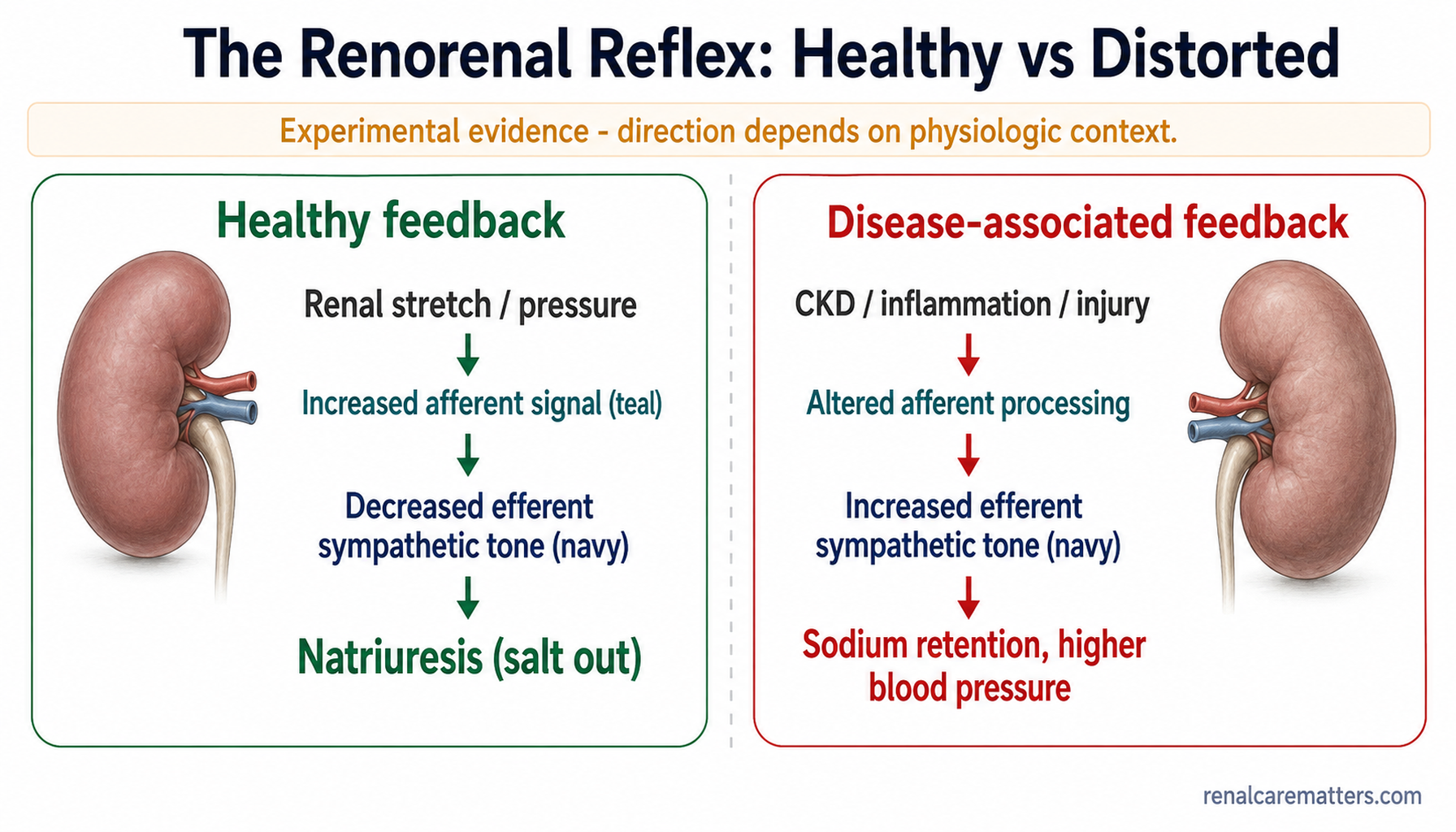 Two-panel reflex diagram. Left panel, healthy feedback: renal stretch raises afferent signal, which lowers efferent sympathetic tone, producing natriuresis. Right panel, disease-associated distorted feedback: chronic kidney disease and inflammation alter afferent processing, which can raise sympathetic tone and sodium retention.