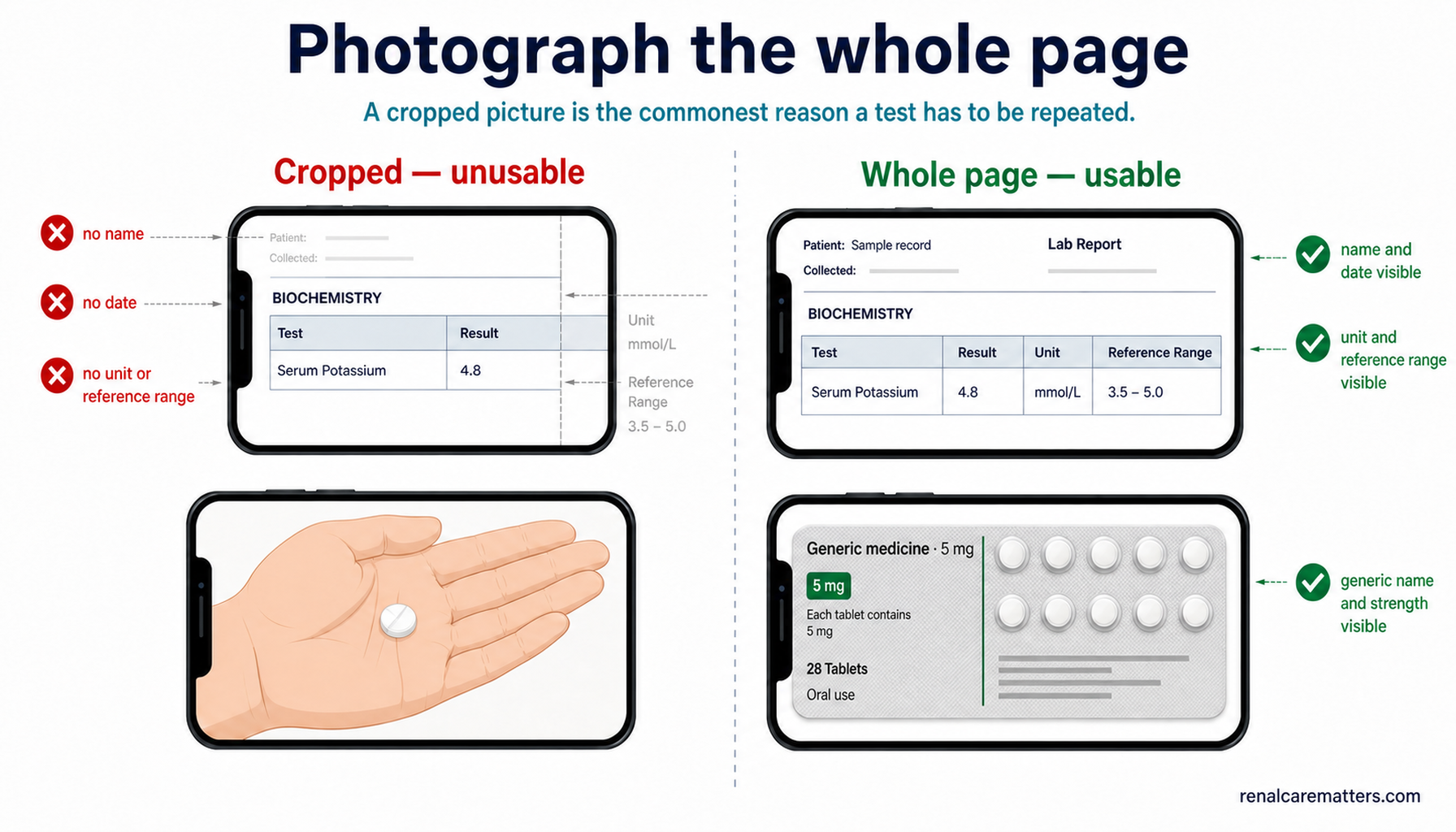 Comparison of unusable and usable record photographs: a laboratory result cropped past its name, date, unit and reference range beside the same report photographed whole.