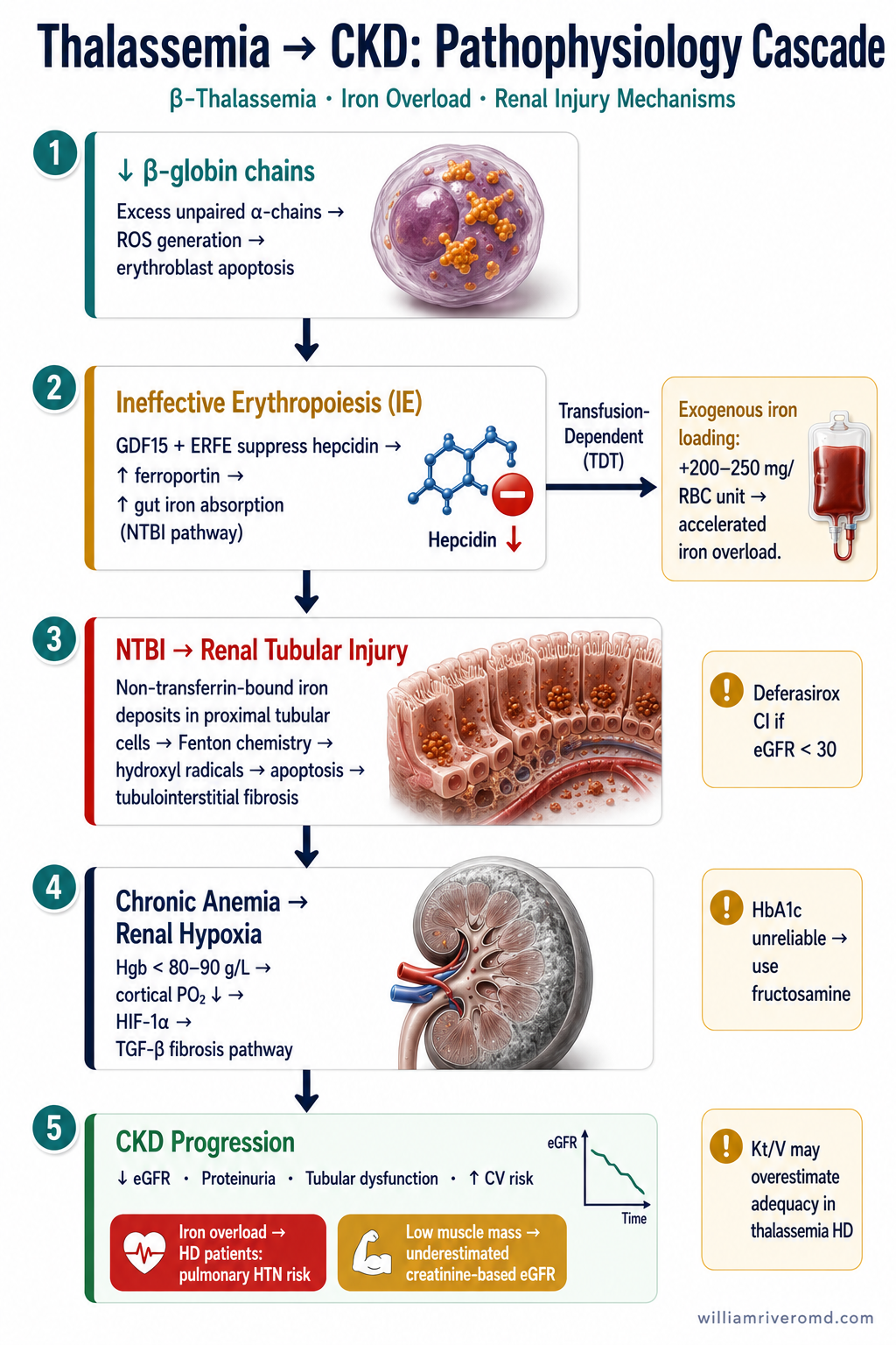 Clinician-grade pathophysiology cascade poster: 5-node vertical flow from β-globin deficiency through ineffective erythropoiesis, hepcidin suppression, NTBI tubular injury, and renal hypoxia to CKD progression — with TDT transfusion branch and clinical pearl sidebar